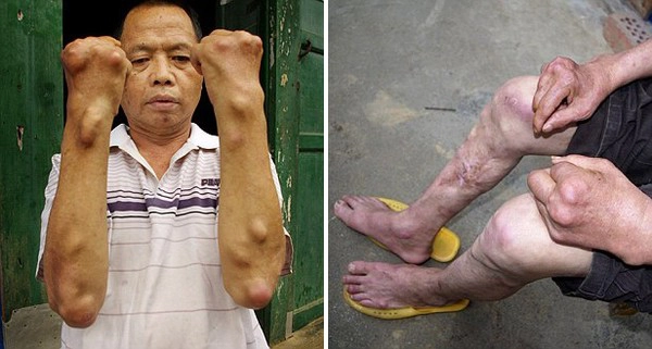 Nhìn những hình ảnh này, bạn còn muốn dùng đồng hồ fake nữa không? nhin nhung hinh anh nay ban con muon dung dong ho fake nua khong 4